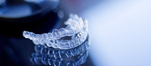 Clear Aligners Specialist Near Me in Norwalk, CT