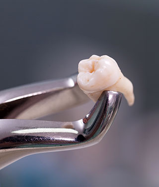 Tooth Extractions Near Me in Norwalk, CT