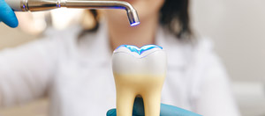 Dental Fillings Specialist Near Me in Norwalk, CT Dental Fillings Specialist Near Me in Norwalk, CT